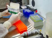 Fundação vai liberar mais 2,8 milhões na sexta-feira