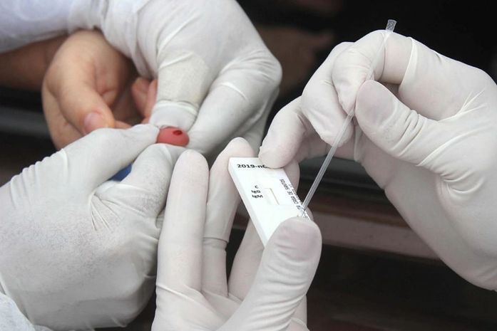 Pesquisa de testagem da população em casa inicia em Maceió