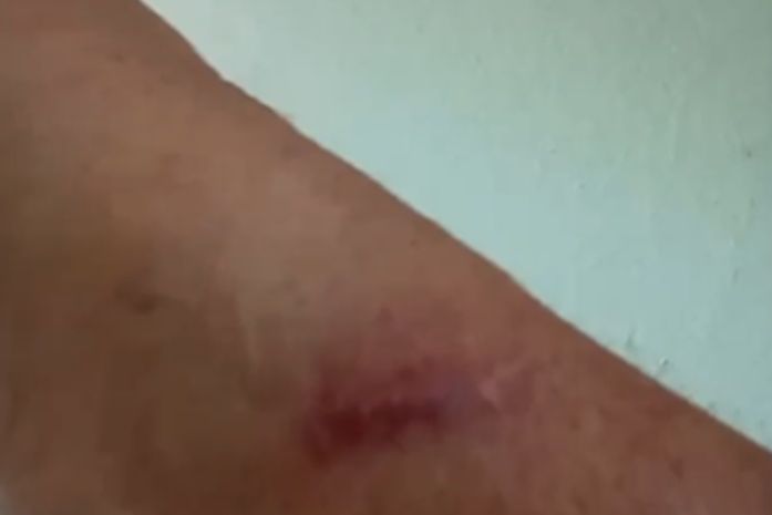Ex-paciente de clínica de reabilitação em Marechal Deodoro registra boletim de ocorrência e denuncia tortura diária no local