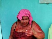 Professora é espancada por ex-aluno e está na UTI no Agreste