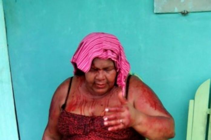 Professora é espancada por ex-aluno e está na UTI no Agreste