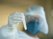USP aponta reinfecção de paciente recuperada da Covid-19 50 dias após 1º teste positivo
