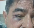 Após vídeo de agressão, ex-prefeito de Olivença se diz vítima e fala em “contexto incompleto”