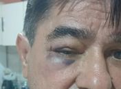 Após vídeo de agressão, ex-prefeito de Olivença se diz vítima e fala em “contexto incompleto”