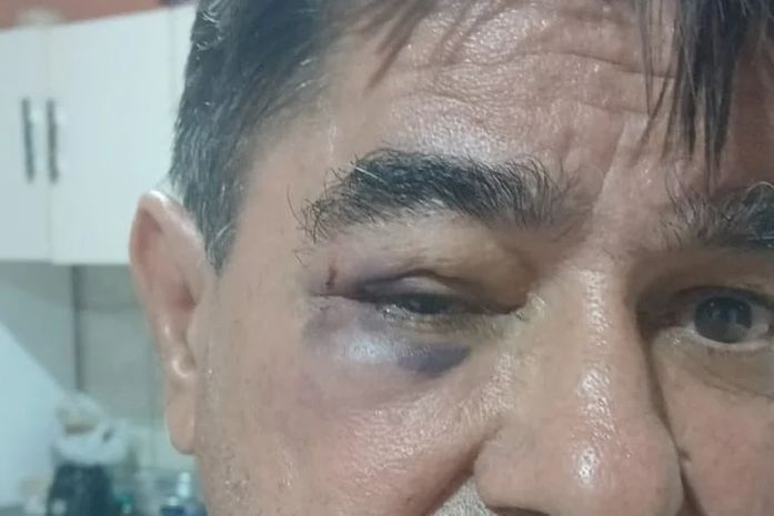 Após vídeo de agressão, ex-prefeito de Olivença se diz vítima e fala em “contexto incompleto”