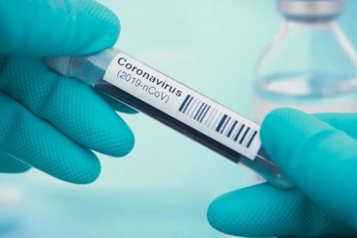 Brasil registra 125.218 casos de coronavírus e 8.536 mortes pela doença