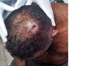 Homem é agredido com golpe de faca na cabeça em Teotônio Vilela