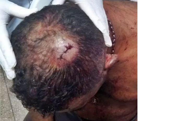 Homem é agredido com golpe de faca na cabeça em Teotônio Vilela
