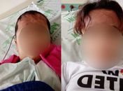 Menina de 9 anos fica 21 dias internada e quase cega após escova progressiva