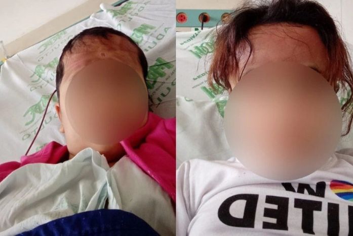 Menina de 9 anos fica 21 dias internada e quase cega após escova progressiva