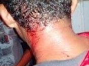 Palhaço fica ferido após ser atingido por pedra durante apresentação