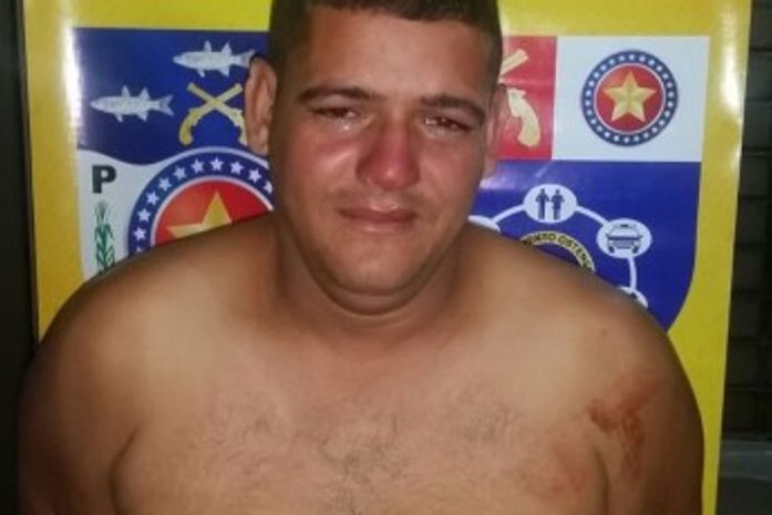 Marido suspeito de atirar na boca de esposa é preso