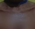 Homem que jogou olho quente na companheira é localizado em PE 