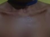 Homem que jogou olho quente na companheira é localizado em PE 