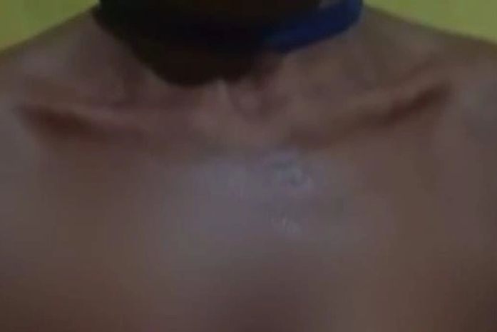 Homem que jogou olho quente na companheira é localizado em PE