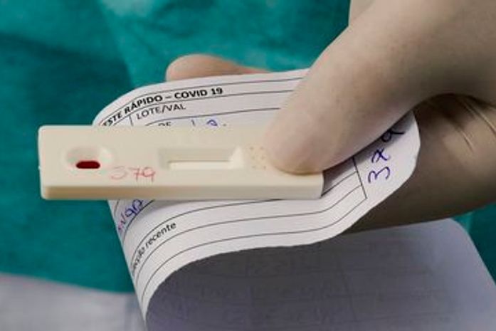 Covid-19: Alagoas registra mais seis mortes e número de óbitos chega a 2.046