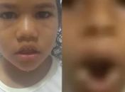 Menino queimado na boca com ovo quente pela avó é irmão de Maria Clara, desaparecida há 3 anos 