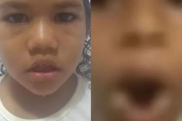 Menino queimado na boca com ovo quente pela avó é irmão de Maria Clara, desaparecida há 3 anos