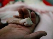 Em média, 15 pessoas morrem de desnutrição por dia no Brasil