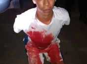 Suspeito de assalto morre e outro é detido após troca de tiros com a polícia no Centro de Maceió