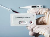 Alagoas confirma 41 casos e cinco óbitos por Covid-19 nas últimas 24 horas