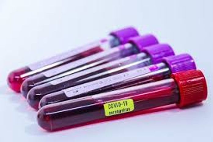 A empregada foi contaminada pela patroa e morreu.Quem vai pagar por isso?