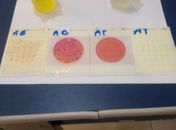 Material usado durante a análise bacteriológica.
