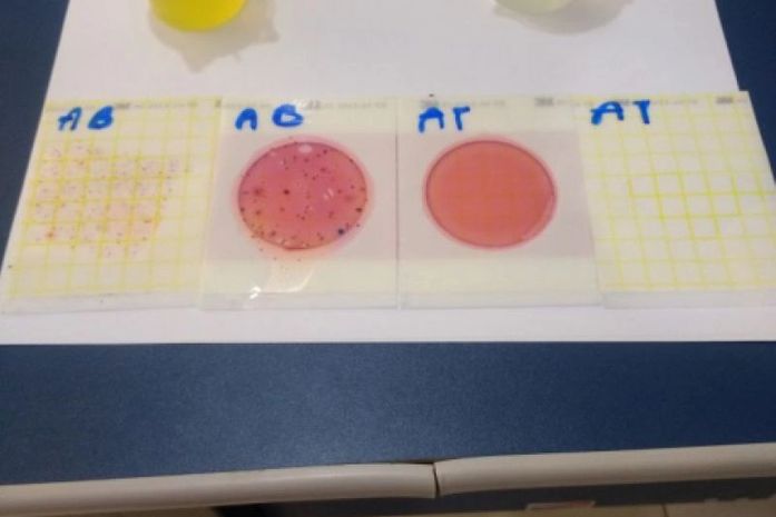 Material usado durante a análise bacteriológica.