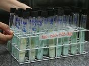 Teste para confirmação de tuberculose utiliza cultura da bactéria em ovos e tubos de ensaio em laboratório