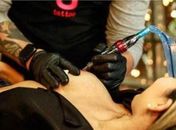 Projeto Y faz tatuagem para a reconstrução da aréola de mulheres que passaram por mastectomia.