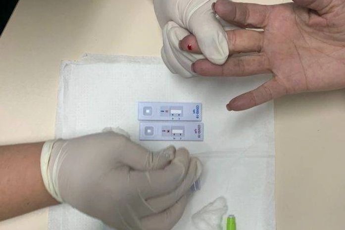 Prefeitura de Arapiraca vai realizar testes rápidos para Covid-19 na população