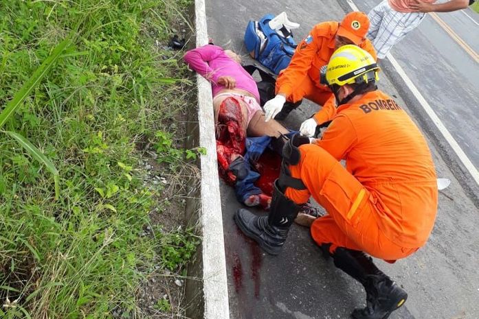 Motociclista tem perna amputada após se envolver em acidente na BR 104