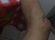 Hoje eu vi a minha vida passar pelos meus olhos sem ter a capacidade de fazer nada-conta Rafael.