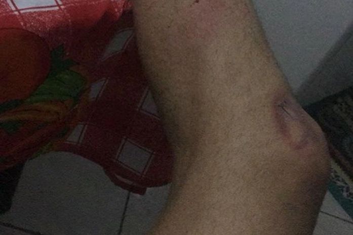 Hoje eu vi a minha vida passar pelos meus olhos sem ter a capacidade de fazer nada-conta Rafael.