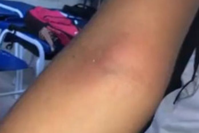 Menina denuncia que foi agredida por professor em escola pública estadual