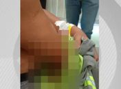 Funcionários da BRK são esfaqueados por morador durante corte de água em Pilar