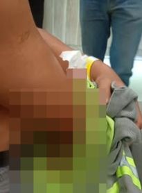 Funcionários da BRK são esfaqueados por morador durante corte de água em Pilar