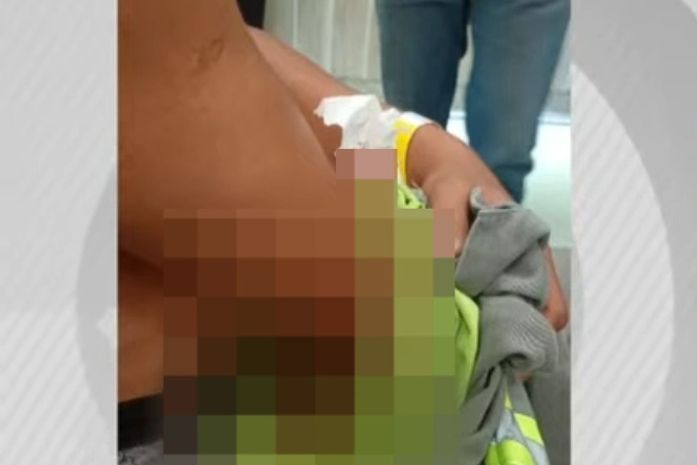 Funcionários da BRK são esfaqueados por morador durante corte de água em Pilar