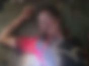 Adolescente é internada após ser estuprada, torturada e ter o rosto desfigurado em Ibateguara; suspeito foi preso