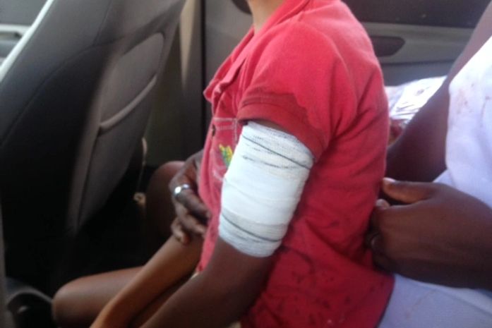 Criança foi atingida no braço