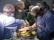 Paciente do primeiro transplante de fígado em Alagoas se recupera bem