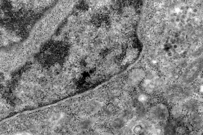 Covid-19: o que se sabe até agora da variante Ômicron
