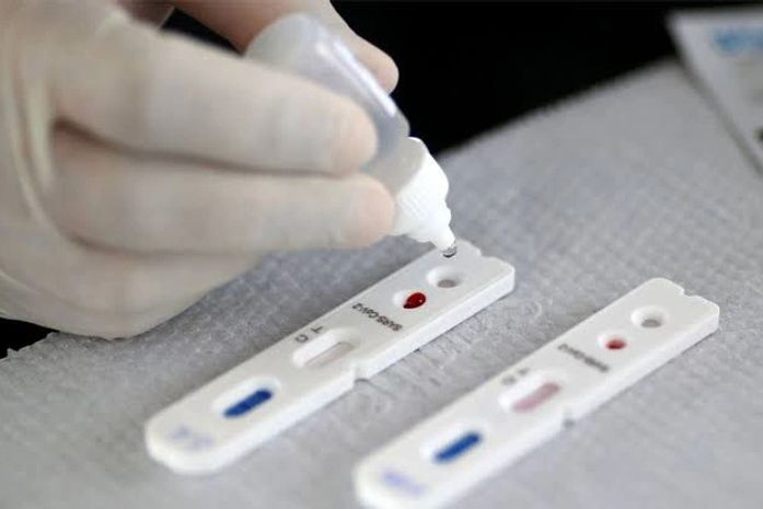 Central de Triagem de Síndromes Gripais retorna a partir desta segunda-feira, 11, em Delmiro Gouveia