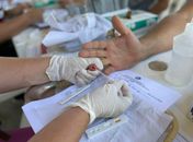 Saúde alerta sobre a importância do teste de HIV para diagnóstico precoce da Aids
