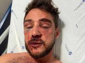 Alagoano mostra como ficou após agressão