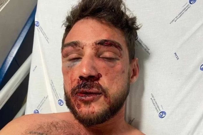 Alagoano mostra como ficou após agressão