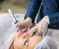 Colágeno: saiba quando e como estimular sua produção