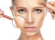 Na era dos “médicos celebridades”, Sociedade de Dermatologia alerta sobre riscos de escolhas baseadas em redes sociais