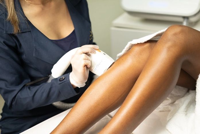 Depilação a laser: saiba em quais áreas pode ser realizada