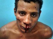 Por ciúmes, homem tenta assassinar esposa a facadas